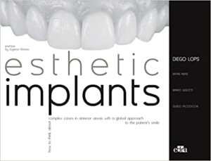 Esthetic Implants. How to Think About Complex Cases in Anterior Areas with a Global Approach to the Patient Smile