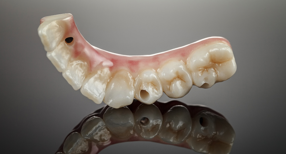 tecnología cad cam aplicada a la implantología oral